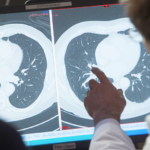 A cure for cancer would deliver $185T economic windfall, report says