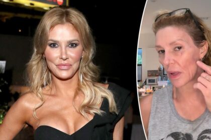 Brandi Glanville speaks out on complex diagnosis and $6K monthly medical battle